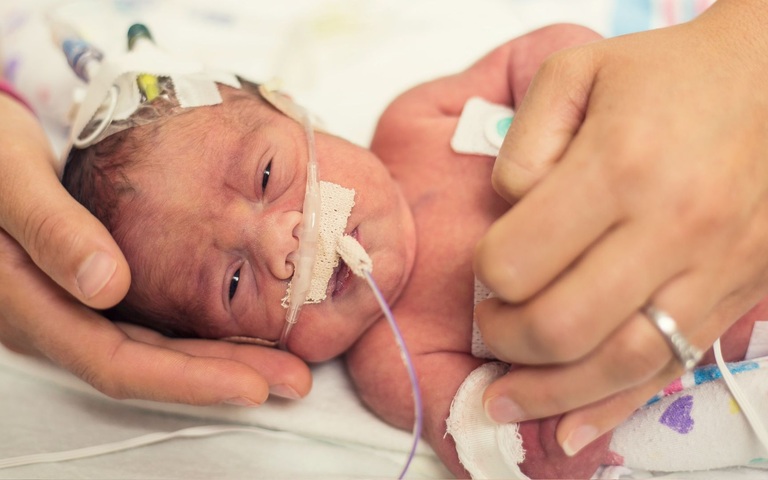 Baby Frühchen Neugeboren Arzt Klinik Krankenhaus Leid Behinderung