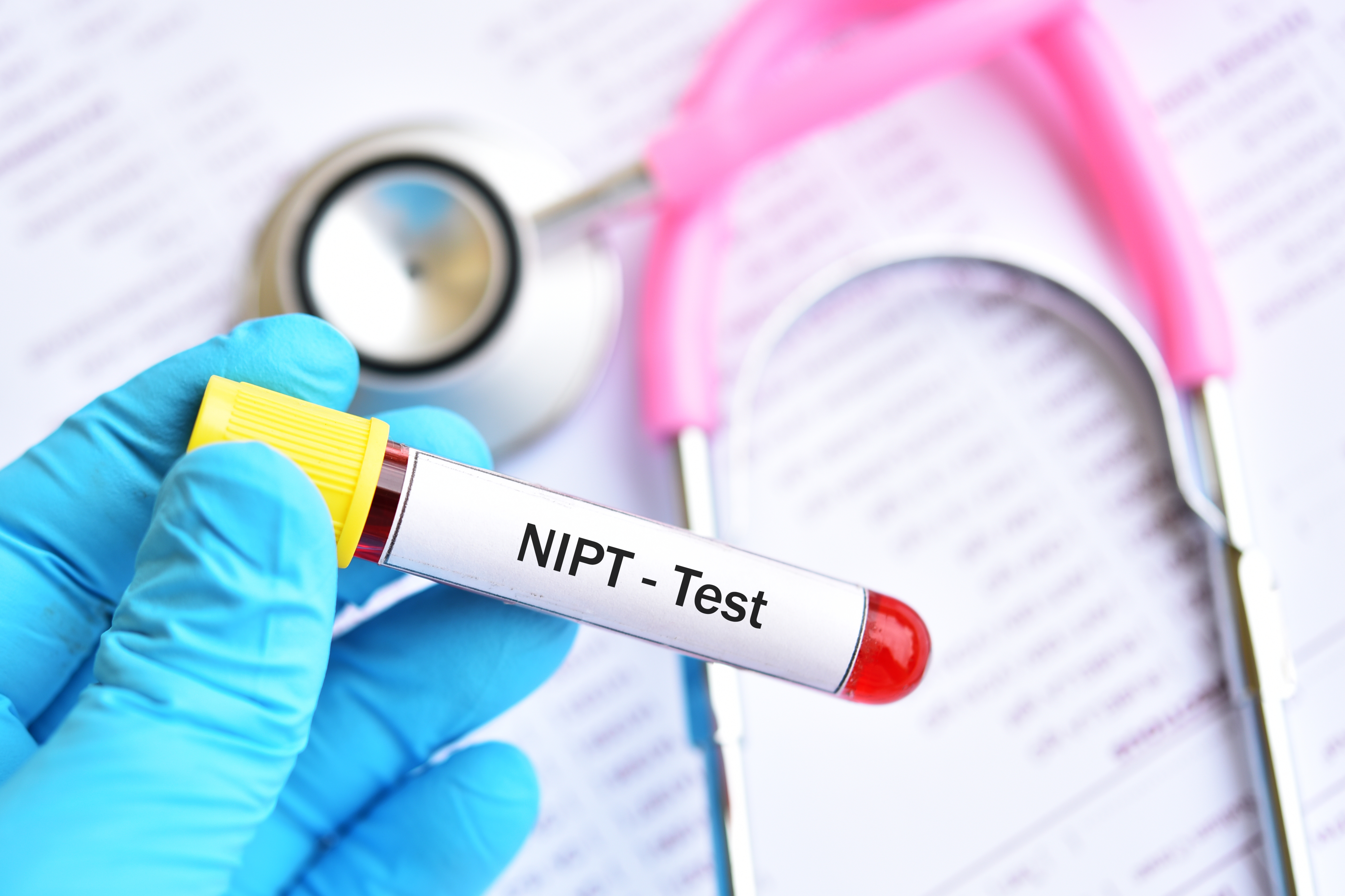 NIPT
