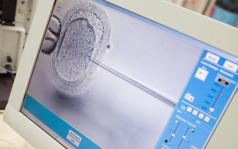 IVF