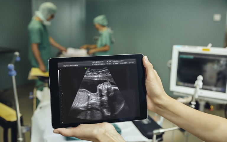 Bild Baby Ultraschall