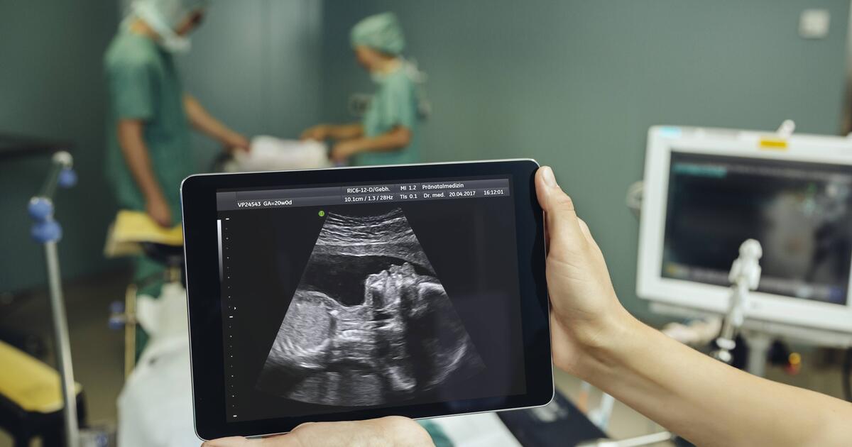 Born in Two: Baby Survives Pregnancy Surgery - News Directory 3